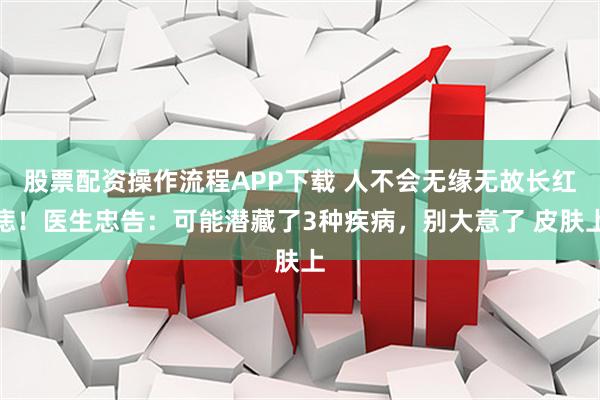 股票配资操作流程APP下载 人不会无缘无故长红痣！医生忠告：可能潜藏了3种疾病，别大意了 皮肤上